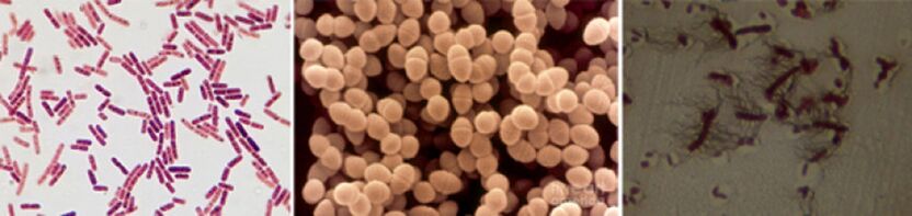 Escherichia coli, fecale enterokokken en Proteus zijn de belangrijkste veroorzakers van chronische bacteriële prostatitis